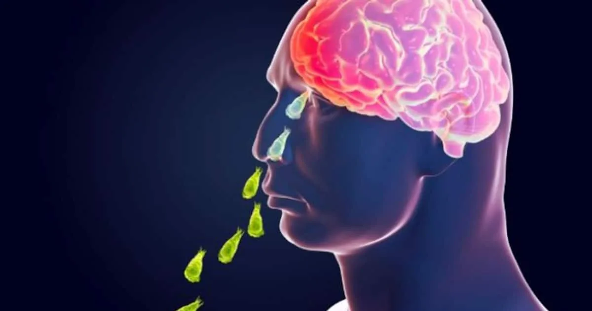 amoebic-meningoencephalitis-1-_1200x630xt.jpg