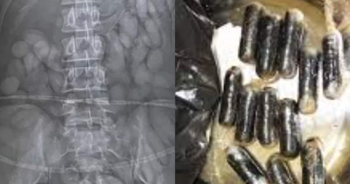cocaine-in-stomach_1200x630xt.jpg