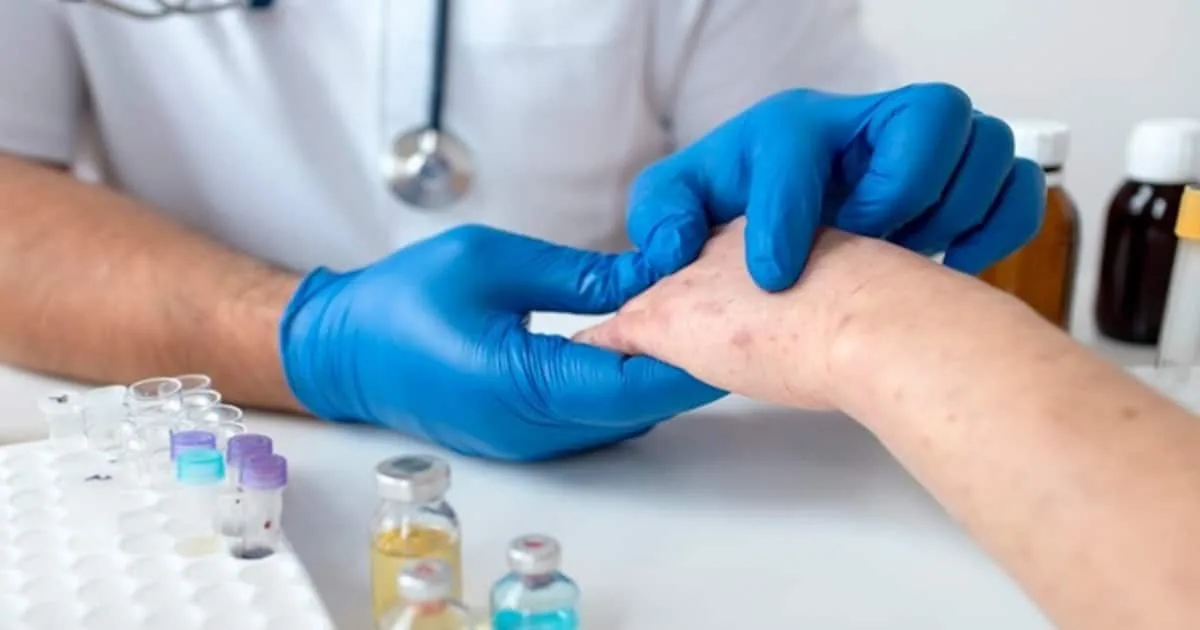 monkeypox-1723878072696_1200x630xt.jpg