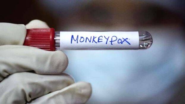 mpox-.1726664389.jpg