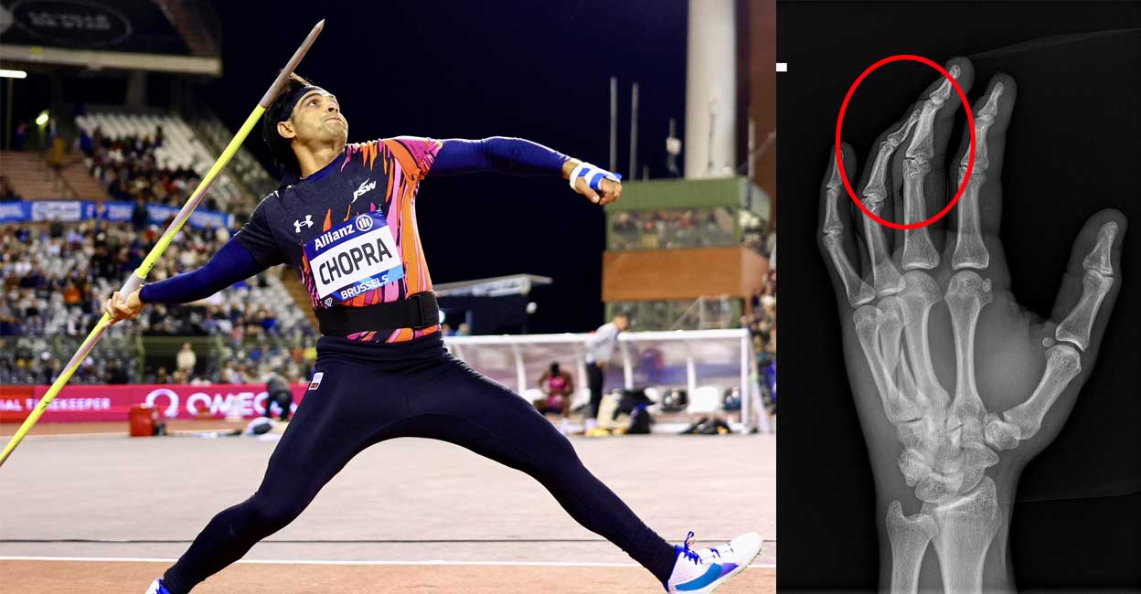 neeraj-chopra-finger.jpg