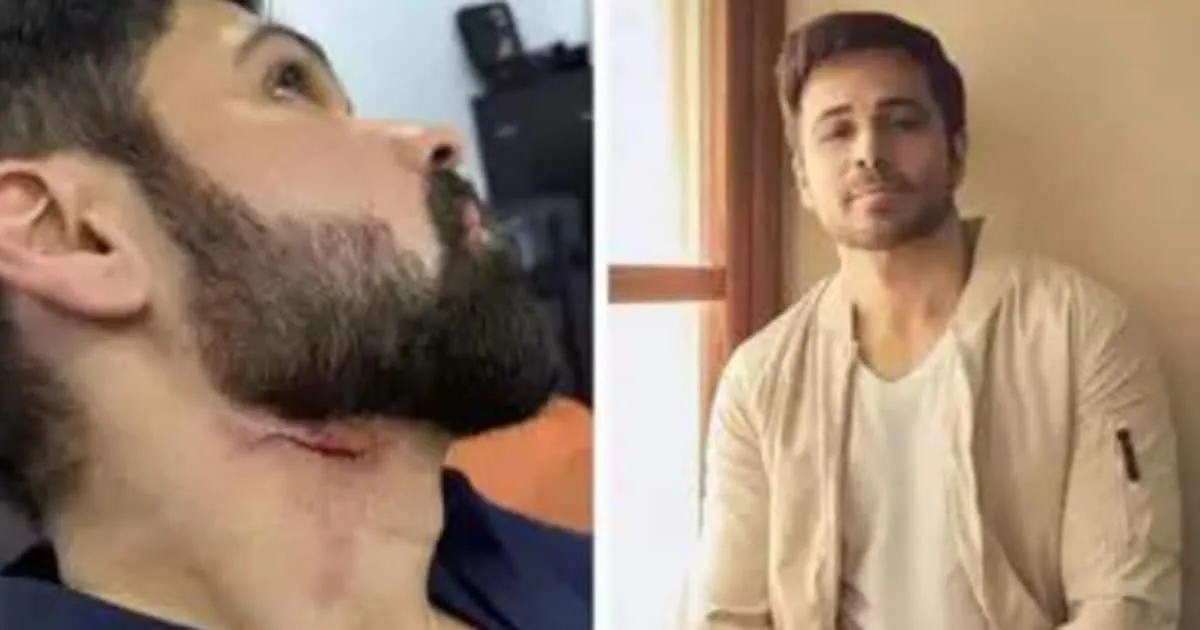 emraan-hashmi-injured-during-film-shooting_1200x630xt.jpg
