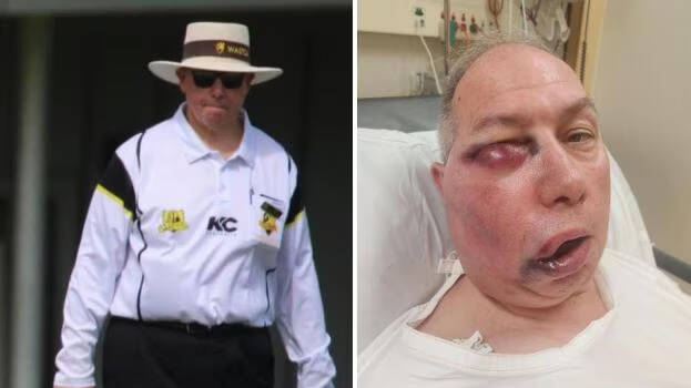 umpire-accident.1.3006784.jpg