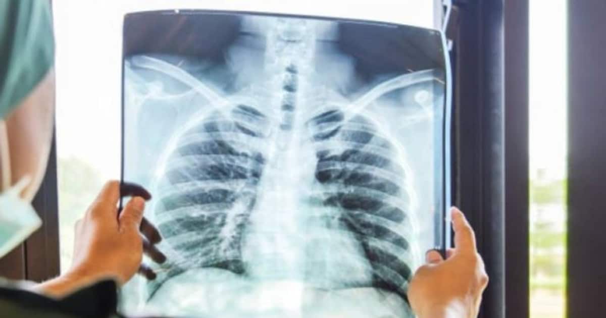 walking-pneumonia_1200x630xt.jpg