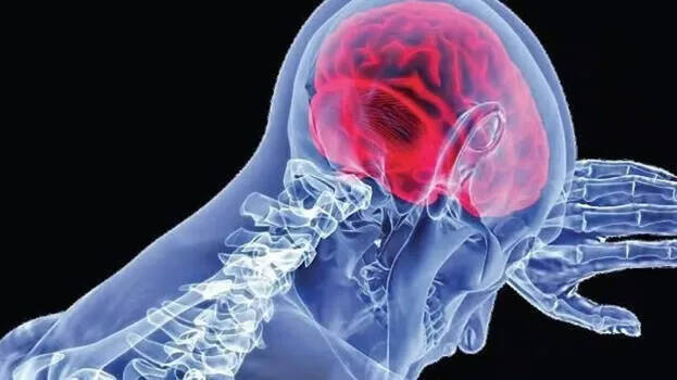 meningitis.1.3179591.jpg
