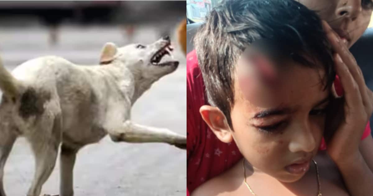 വീട്ടുമുറ്റത്ത് കളിച്ചുകൊണ്ടിരുന്ന അഞ്ചു വയസുകാരിക്ക് നേരെ തെരുവ് നായയുടെ ആക്രമണം