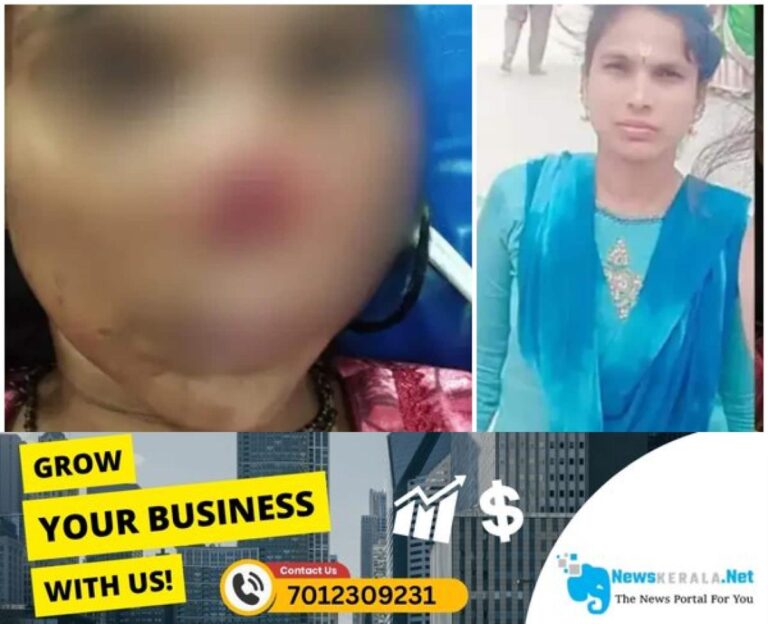 admerged_1752350505_wife-nose-bite-1752349746969_1280x720xt