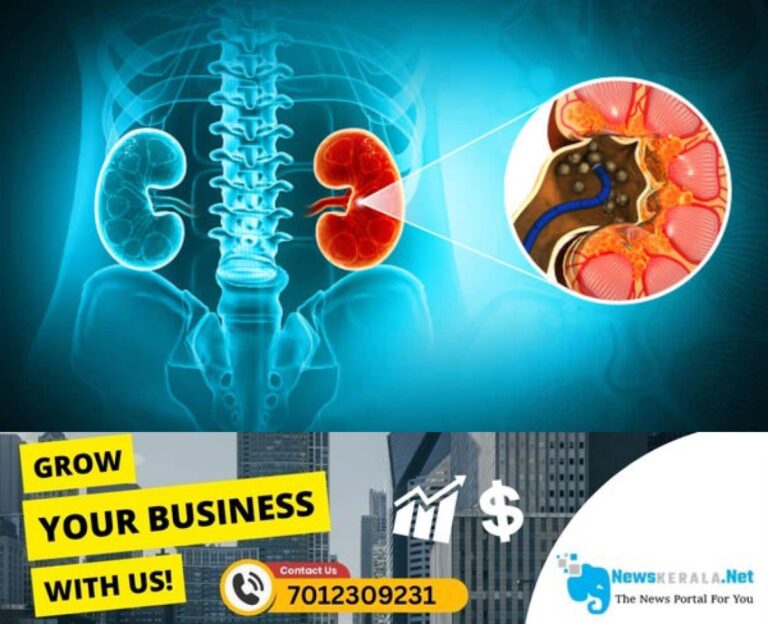 admerged_1752400004_kidney-stones-5-1751521123305_1280x720xt