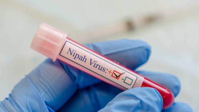 nipah-virus-spread-causes-prevention-5-1752489732833_1280x720xt.jpg