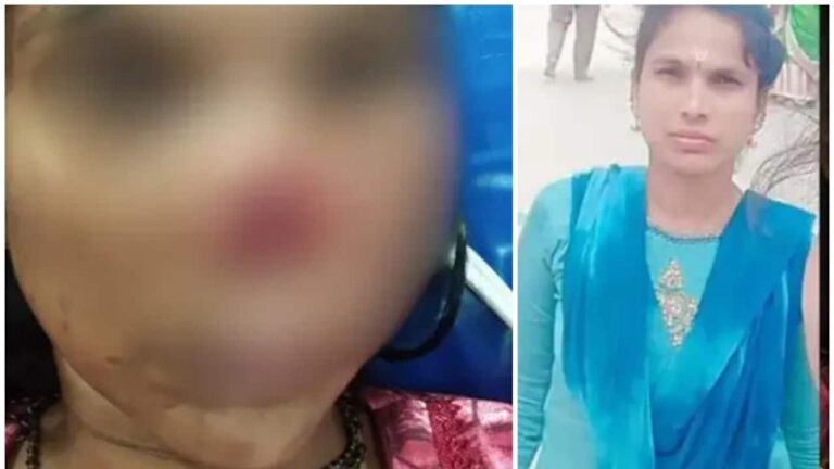 wife-nose-bite-1752349746969_1280x720xt.jpg