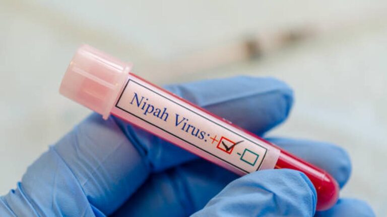 w-1280h-720format-jpgimgid-01k048eaq1yszqesr4e3fgaxpjimgname-nipah-virus-spread-causes-preventi.jpeg