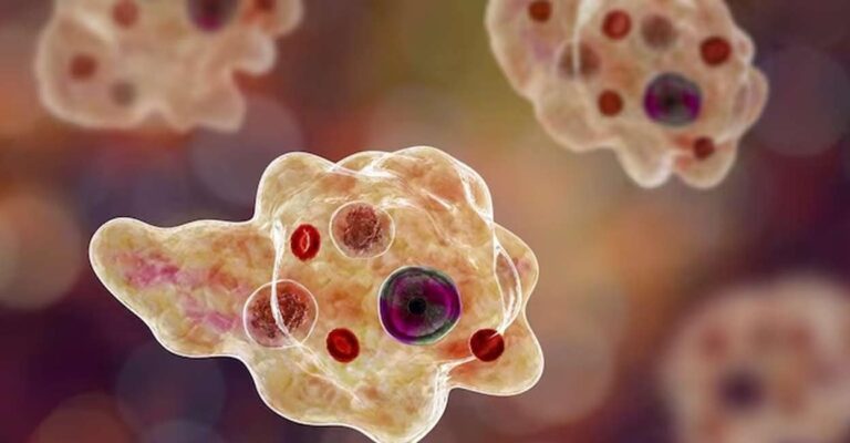 amoebic-meningoencephalitis-0507.jpg