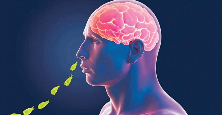 amoebic-meningoencephalitis.jpg