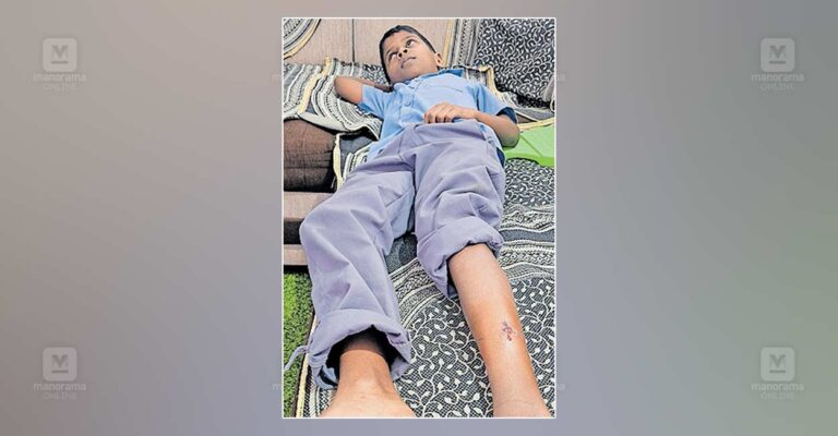 child-injured.jpg