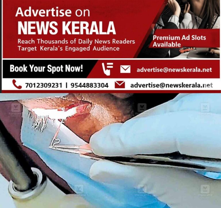 newskerala.net_1756876520_palalkad-eye-issue