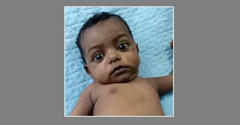 infant-liver-transplant-urgent.jpg