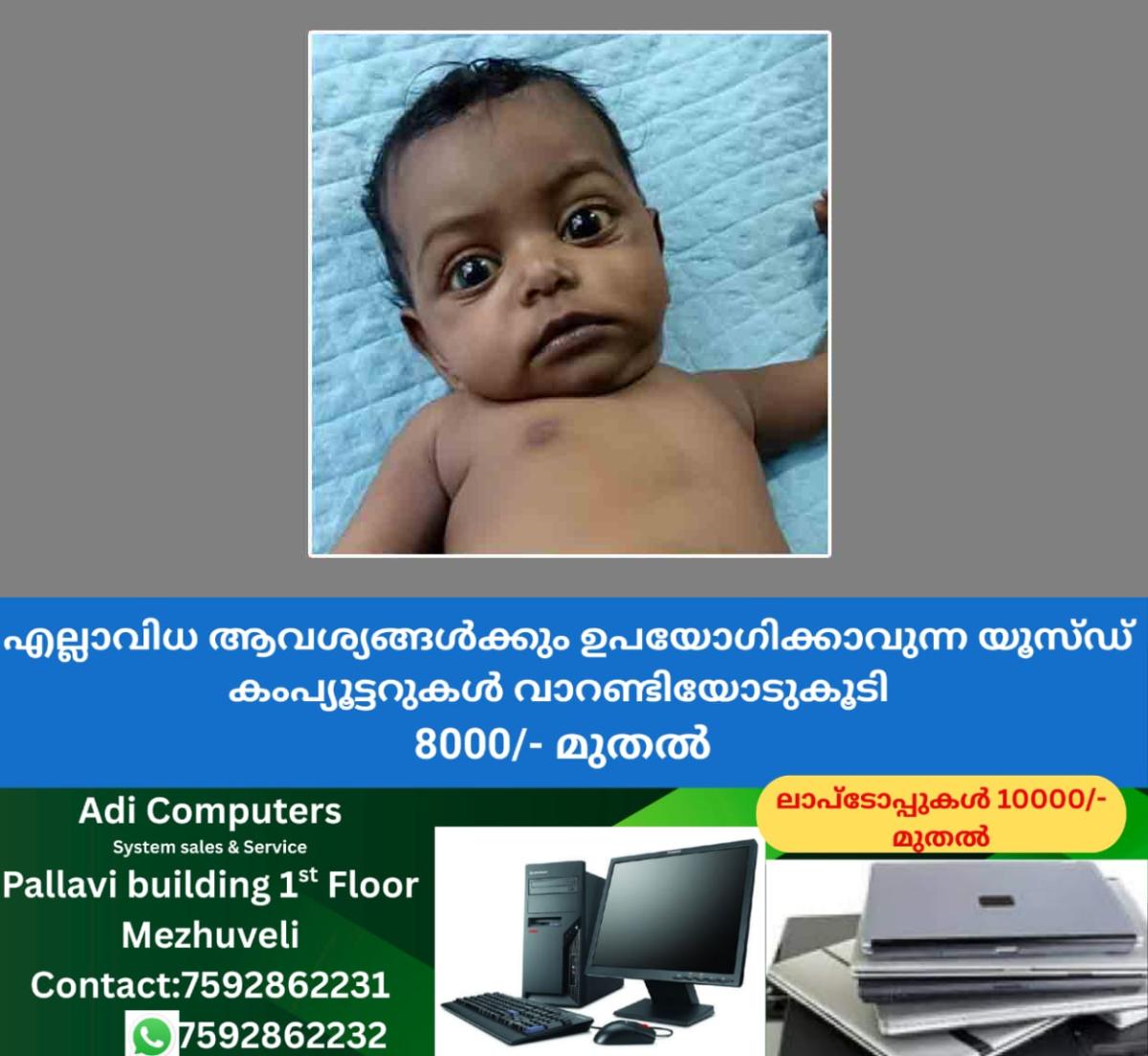newskerala.net_1759740737_infant-liver-transplant-urgent