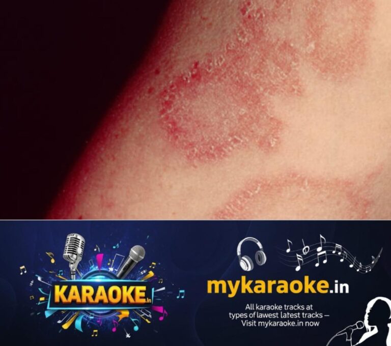 newskerala.net_1759880786_w-1280h-720format-jpgimgid-01k70gjymepg4y6c10cyb9j39dimgname-skin-rashes-1759880247949