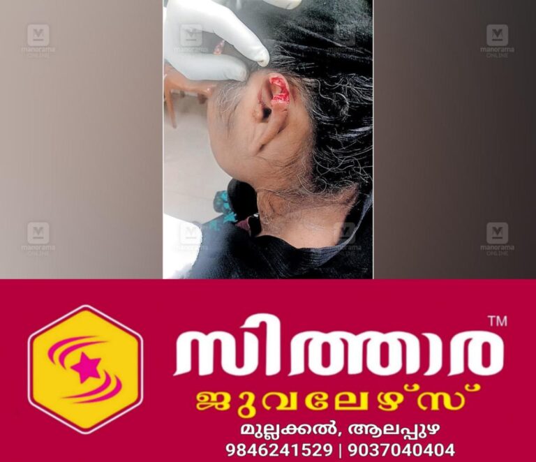 newskerala.net_1760162343_1760162194_stray-dog-attack