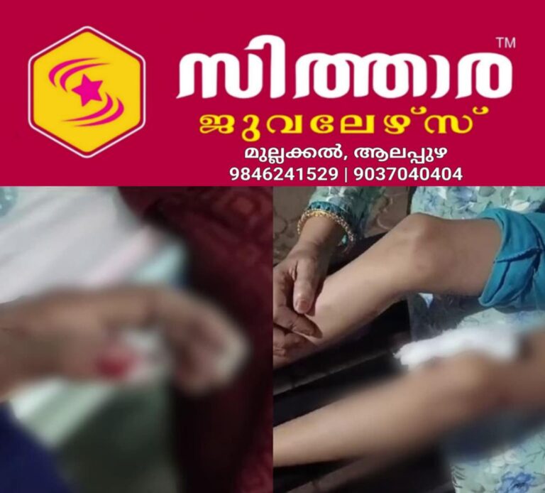 newskerala.net_1760581345_w-1280h-720format-jpgimgid-01hz07ws7bxqf0zj5w33ytgx2mimgname-stray-dog-attack