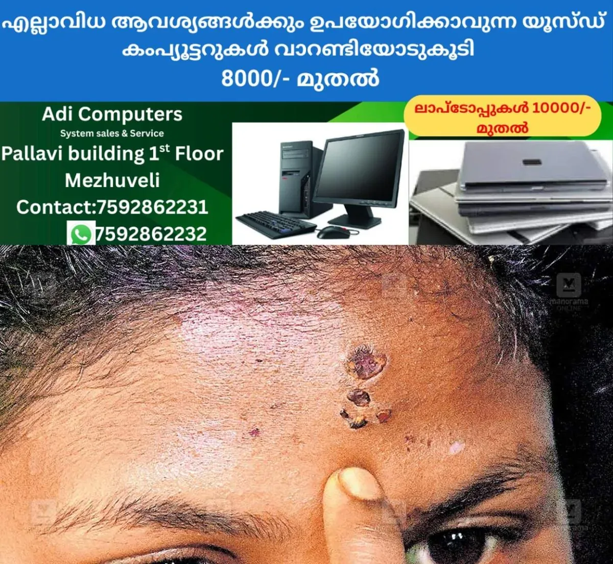 newskerala.net_1762667343_ktm-woman-tortured-sorcery-ritual