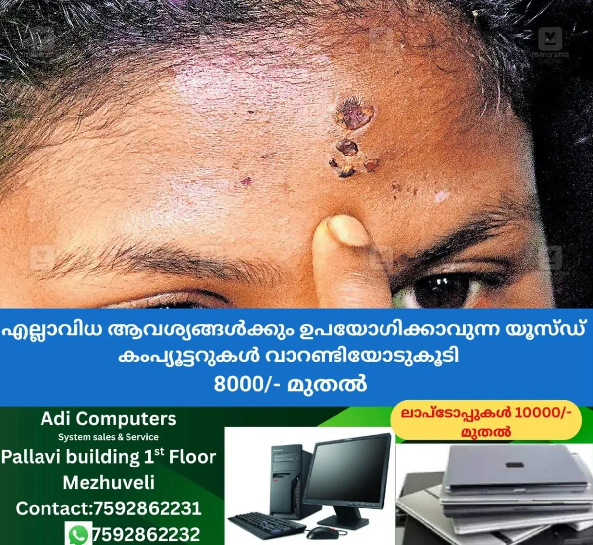 newskerala.net_1762761845_ktm-woman-tortured-sorcery-ritual