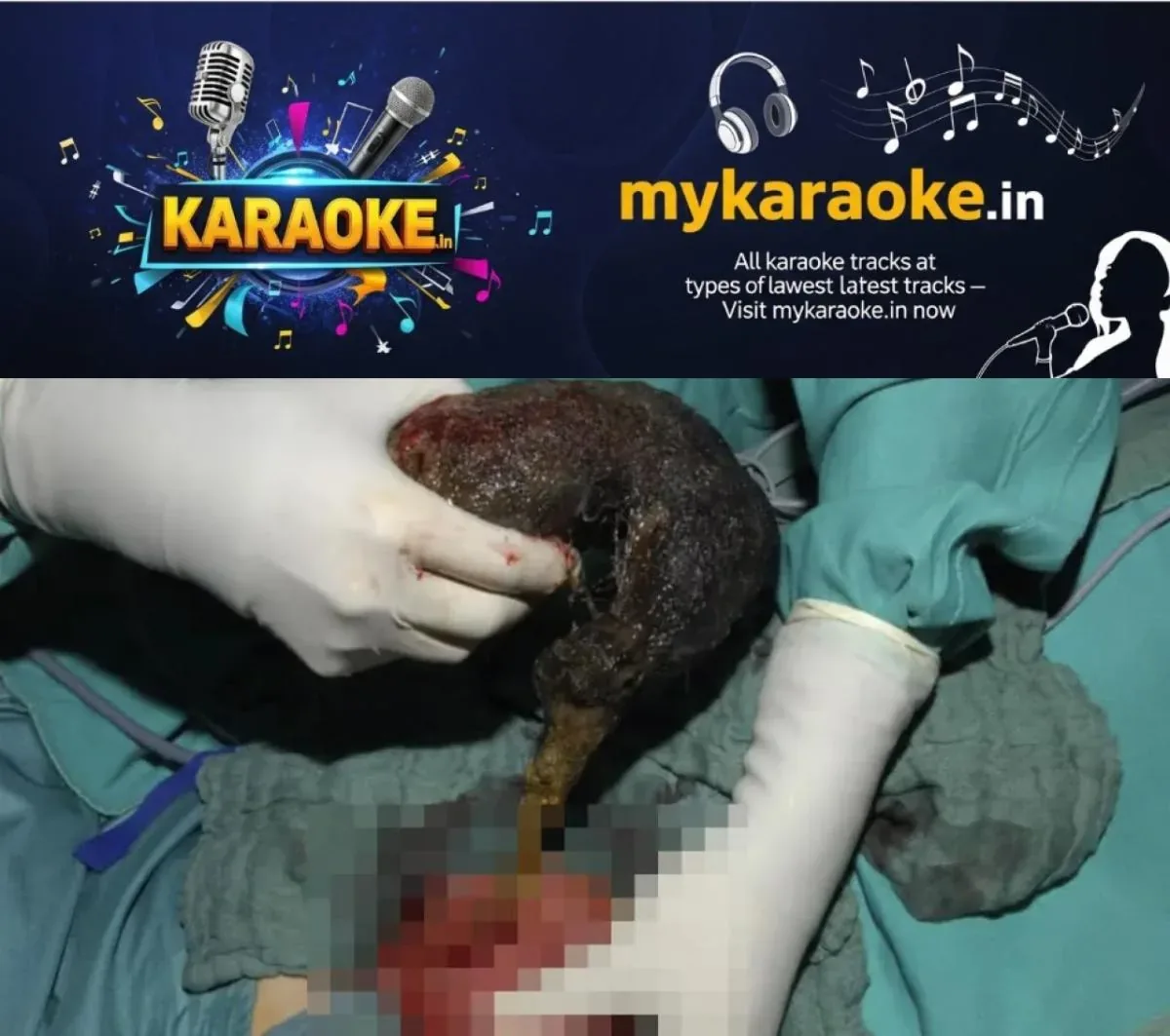 newskerala.net_1762797018_w-1280h-720format-jpgimgid-01k9qcg86b4t4zpj7wckqwefe1imgname-hair-ball-1762795200715