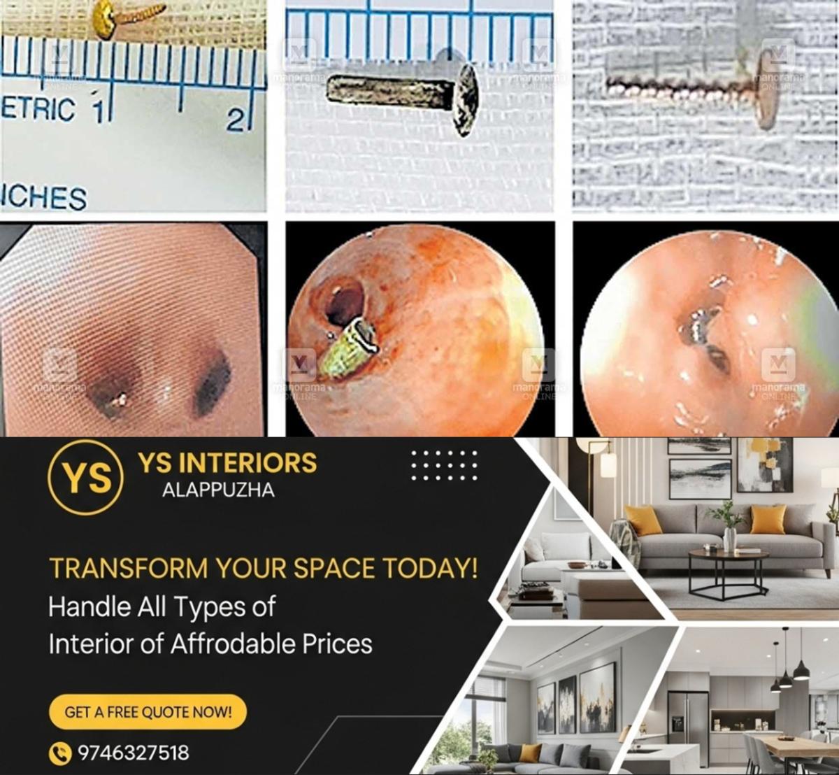 newskerala.net_1764644529_ernakulam-stud-incident