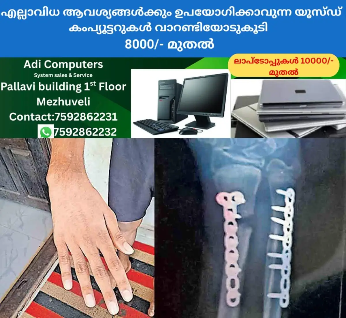 newskerala.net_1771558225_medical-negligence-pathanamthitta