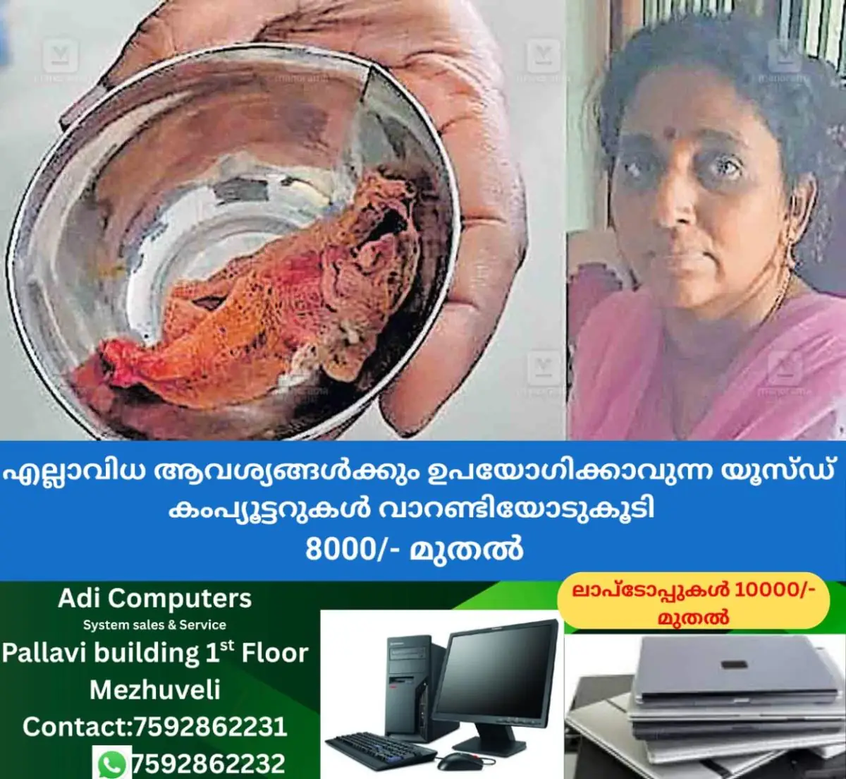 newskerala.net_1772935808_cloth-left-in-stomach-surgery-1