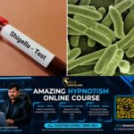 newskerala.net_1782489012_shigella-1-1
