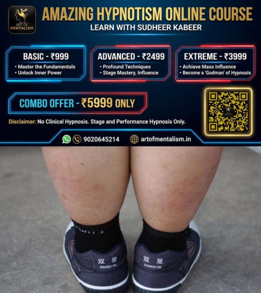 newskerala.net_1782718927_w-1280h-720format-jpgimgid-01kw94t3991jm5d7xvvq2jhyhqimgname-obesity-in-children-1782718467369.j