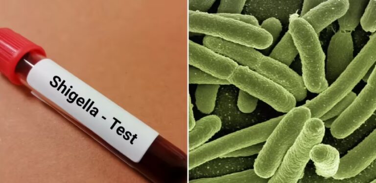 shigella-1-1.jpg