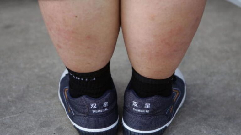 w-1280h-720format-jpgimgid-01kw94t3991jm5d7xvvq2jhyhqimgname-obesity-in-children-1782718467369.j.jpeg