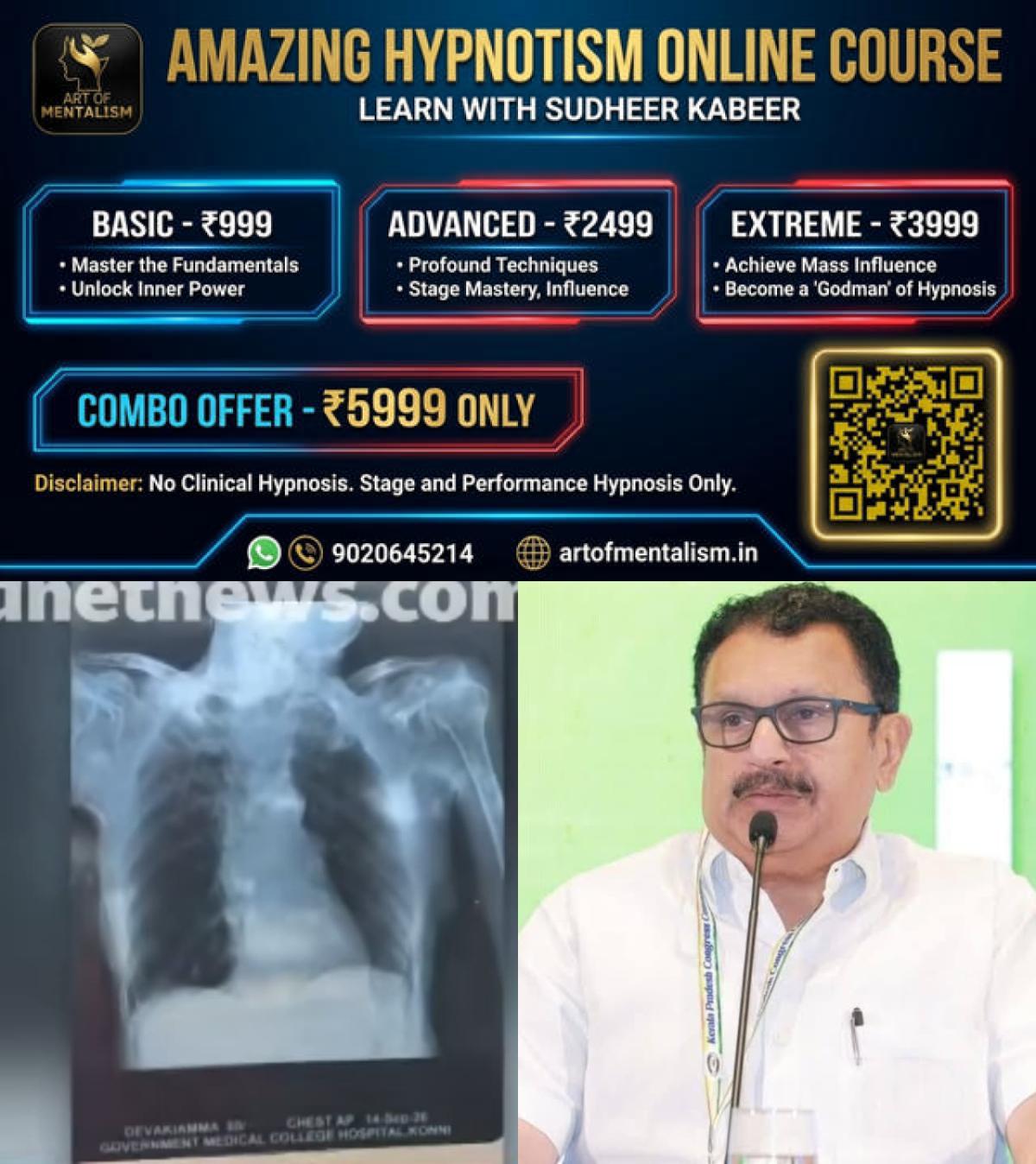 newskerala.net_1789792268_w-1280h-720format-jpgimgid-01m2vxgfa1mxrfxtywx9hh0nevimgname-konni-medical-college-xray-issue-17