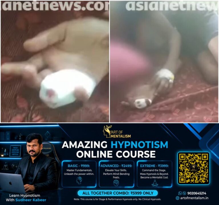newskerala.net_1789888808_w-1280h-720format-jpgimgid-01m2yss354657as55wh1xaatf5imgname-thiruvananthapuram-stray-dog-attack