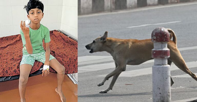 stray-dog-bites-child.jpg