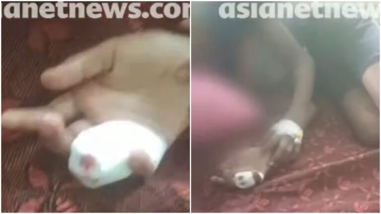 w-1280h-720format-jpgimgid-01m2yss354657as55wh1xaatf5imgname-thiruvananthapuram-stray-dog-attack.jpeg