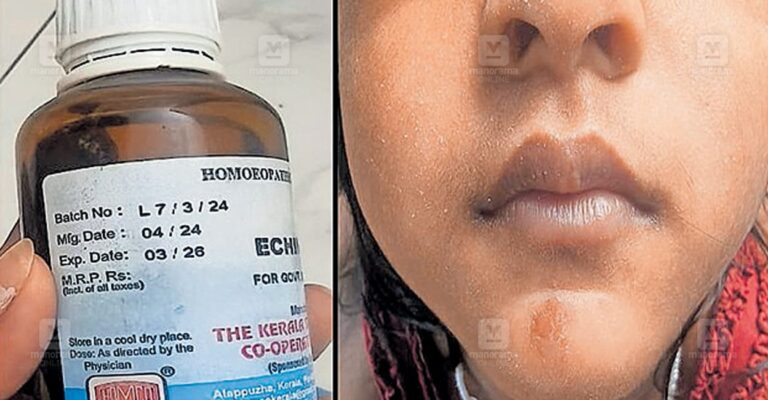 attingle-homeo-expired-medicine-1.jpg