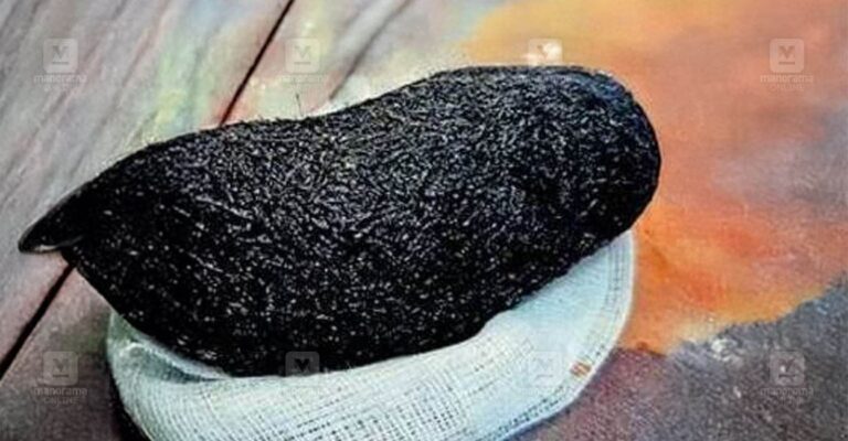 child-hairball-surgery-neyyattinkara.jpg