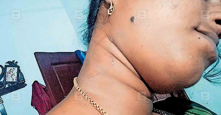 dowry-harassment.jpg
