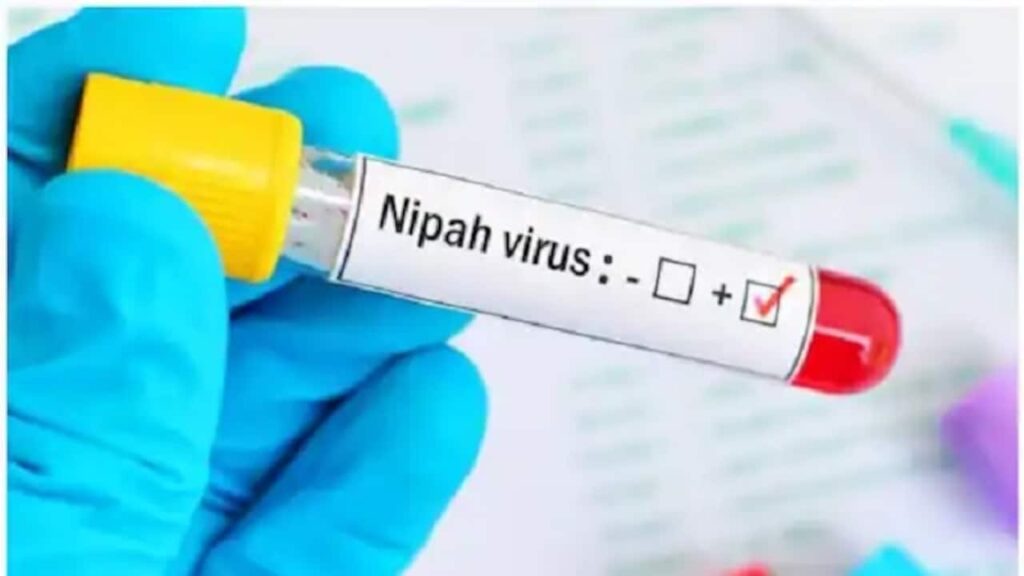 Nipah-virus-1694595346558_1280x720xt.jpg